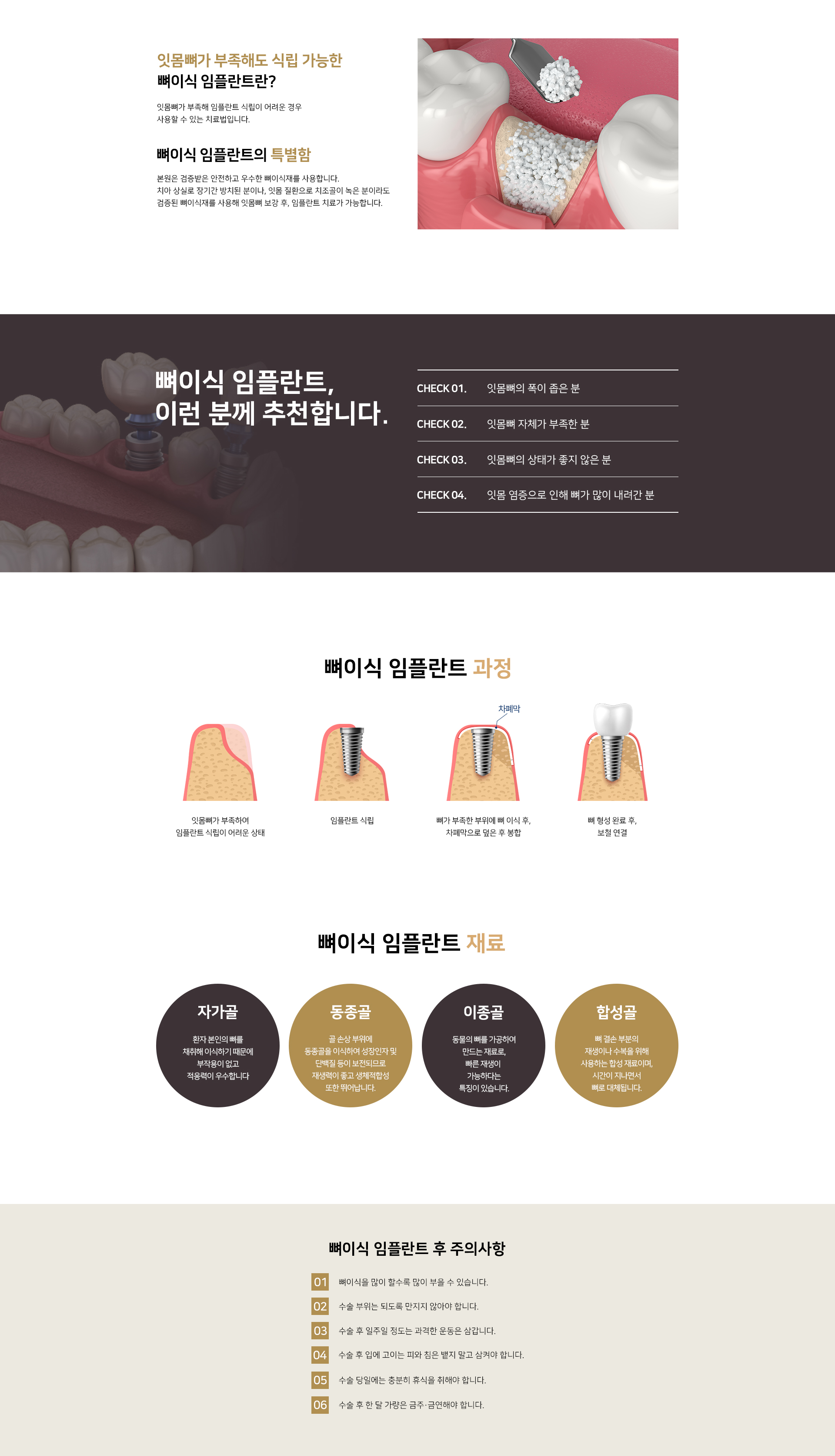 시니어 임플란트